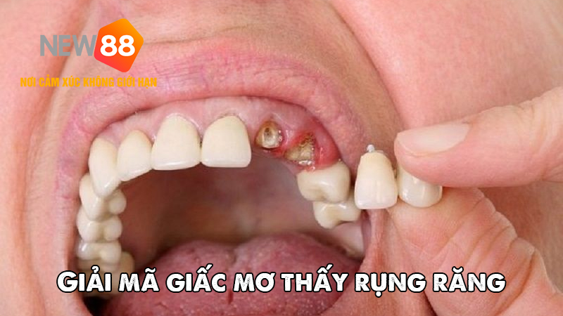 G&oacute;c nh&igrave;n khoa học qua giấc mơ thấy rụng răng